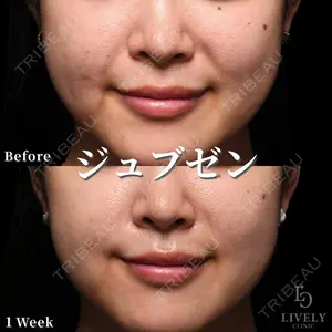 null days after image