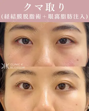 null days after image