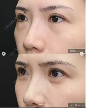 null days after image