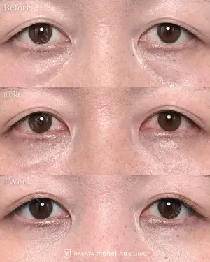 null days after image