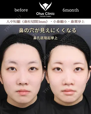 180 days after image