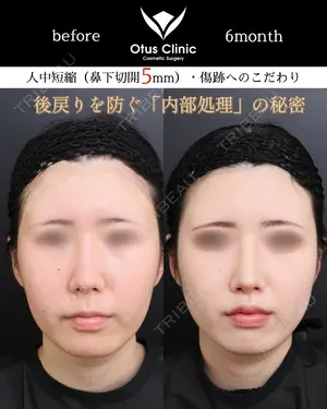 180 days after image