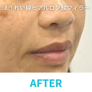 null days after image