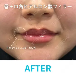 null days after image