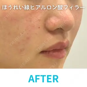 null days after image