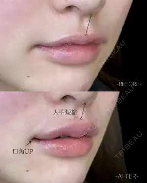 null days after image