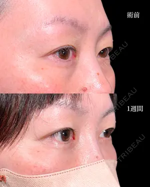 before image