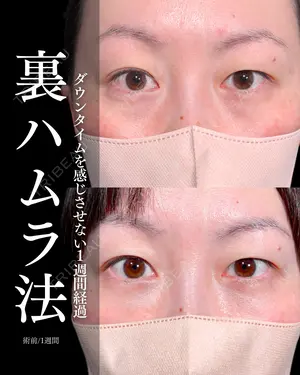 7 days after image