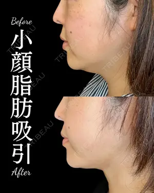 null days after image