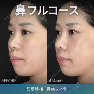 120 days after image