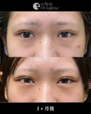 30 days after image