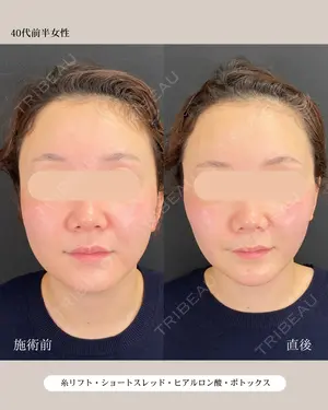 null days after image