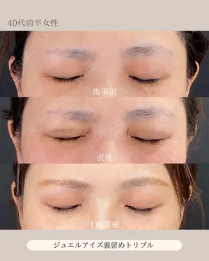 null days after image