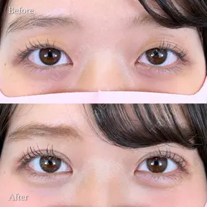 null days after image