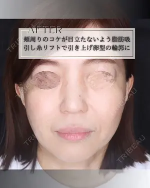 null days after image