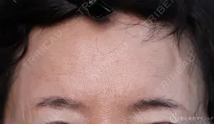 210 days after image