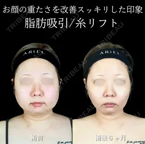 180 days after image