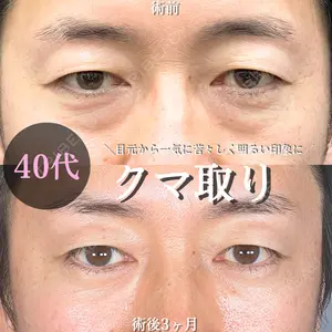 90 days after image