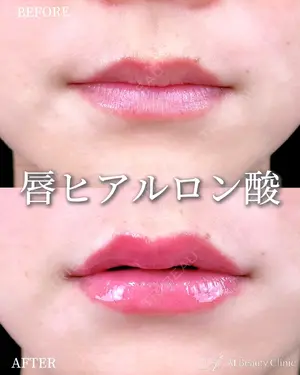 null days after image