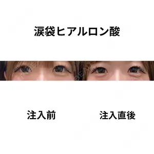 null days after image