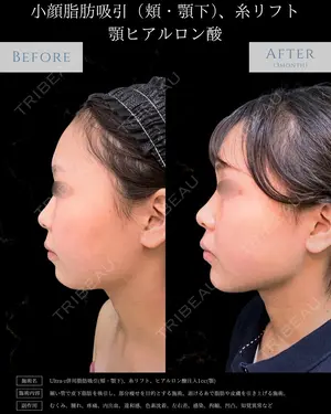 null days after image