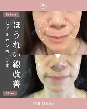 null days after image