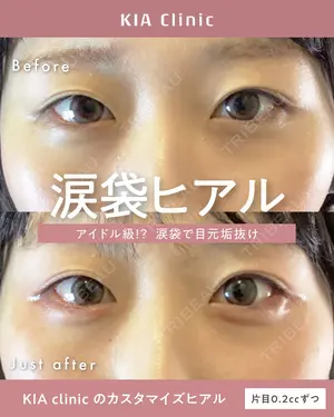 null days after image