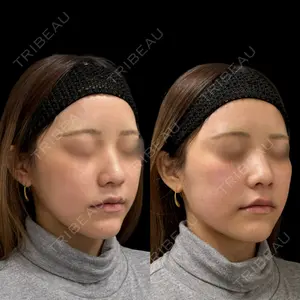 null days after image