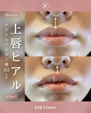 null days after image