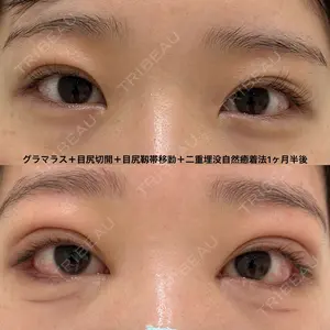 null days after image