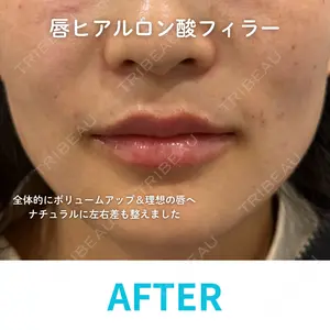 null days after image