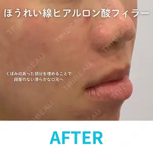 null days after image