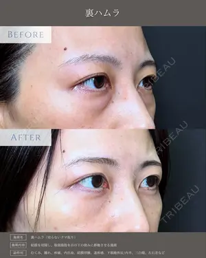 null days after image