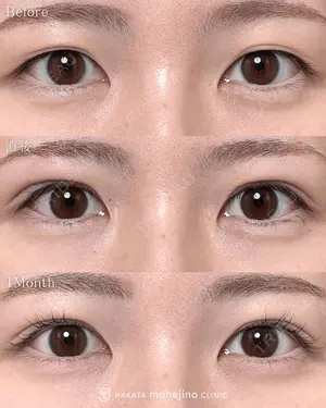 null days after image