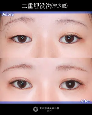 90 days after image