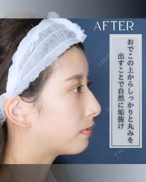 null days after image