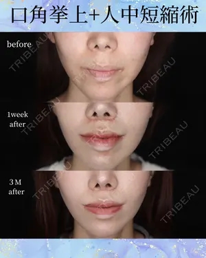 null days after image