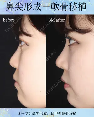 null days after image