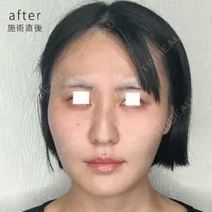 null days after image