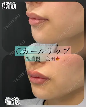 null days after image