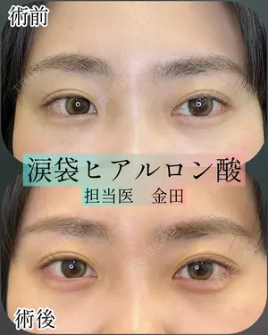 null days after image