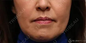 1825 days after image