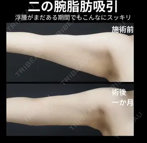 30 days after image