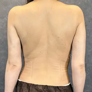 null days after image