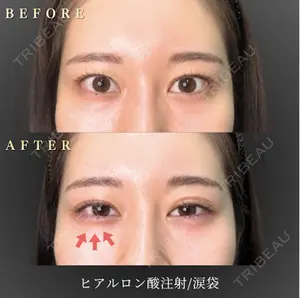 null days after image