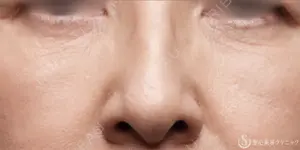 2190 days after image