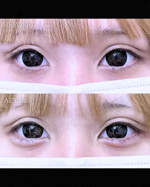 null days after image