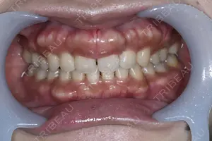 before image