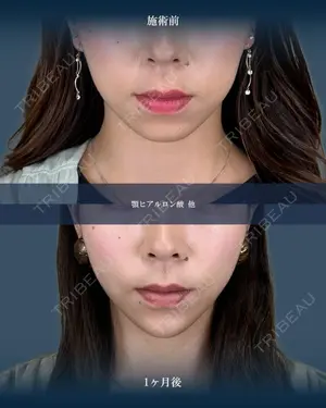 null days after image