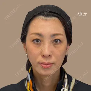 1095 days after image